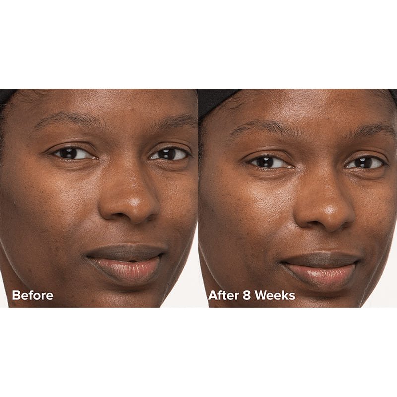 Paula's Choice Skin Perfecting 6% Mandelic Acid + 2% Lactic Acid Liquid Exfoliant | #1 Exfoliation Experts | Innovative Formula | Gentle yet Effective Exfoliation | Time-Released 8% AHA Multi-Layer Complex | Improves Radiance, Softens Texture | Promotes Healthier Skin Turnover | Youthful Glow