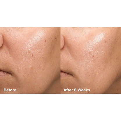 Paula's Choice Skin Perfecting 6% Mandelic Acid + 2% Lactic Acid Liquid Exfoliant | Crafted by #1 Exfoliation Experts | Innovative Formula | 6% Mandelic Acid, 2% Lactic Acid | Gentle yet Effective Exfoliation | Time-Released 8% AHA Multi-Layer Complex | Improves Radiance, Softens Texture | Promotes Healthier Skin Turnover | Youthful Glow