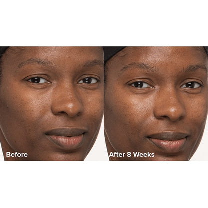 Paula's Choice Skin Perfecting 6% Mandelic Acid + 2% Lactic Acid Liquid Exfoliant | Crafted by #1 Exfoliation Experts | Innovative Formula | 6% Mandelic Acid, 2% Lactic Acid | Gentle yet Effective Exfoliation | Time-Released 8% AHA Multi-Layer Complex | Improves Radiance, Softens Texture | Promotes Healthier Skin Turnover | Youthful Glow