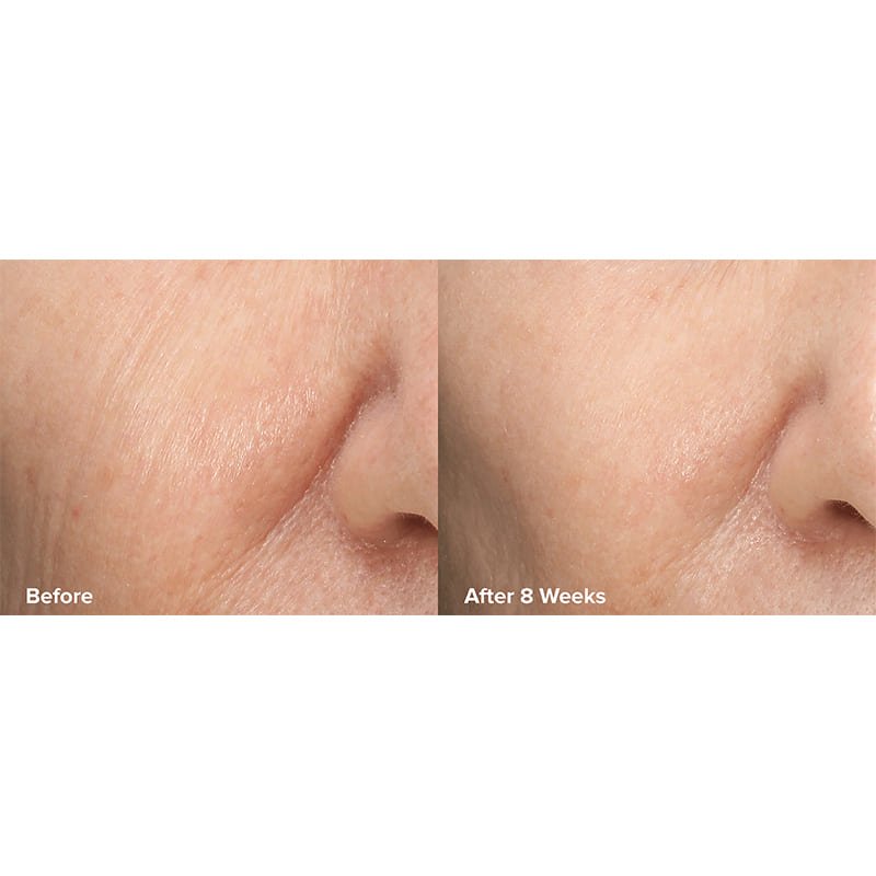 Paula's Choice Skin Perfecting 6% Mandelic Acid + 2% Lactic Acid Liquid Exfoliant | Crafted by #1 Exfoliation Experts | Innovative Formula | 6% Mandelic Acid, 2% Lactic Acid | Gentle yet Effective Exfoliation | Time-Released 8% AHA Multi-Layer Complex | Improves Radiance, Softens Texture | Promotes Healthier Skin Turnover | Youthful Glow