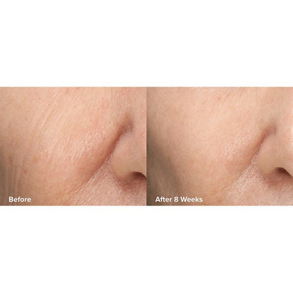 Paula's Choice Skin Perfecting 6% Mandelic Acid + 2% Lactic Acid Liquid Exfoliant | Crafted by #1 Exfoliation Experts | Innovative Formula | 6% Mandelic Acid, 2% Lactic Acid | Gentle yet Effective Exfoliation | Time-Released 8% AHA Multi-Layer Complex | Improves Radiance, Softens Texture | Promotes Healthier Skin Turnover | Youthful Glow
