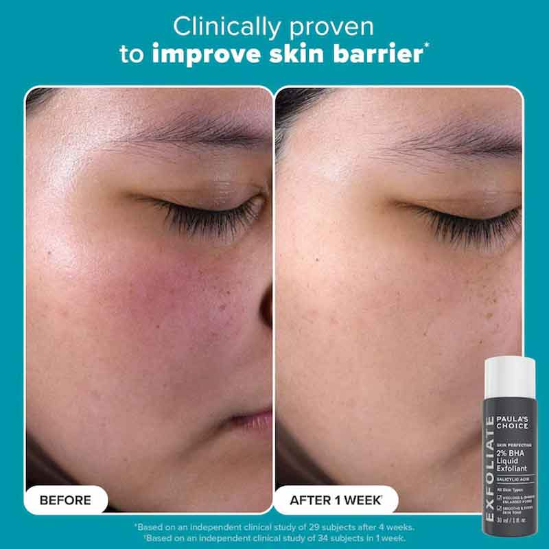 Paula's Choice 2% BHA Liquid Exfoliant, Salicylic Acid Toner, damaged skin barrier, textured skin