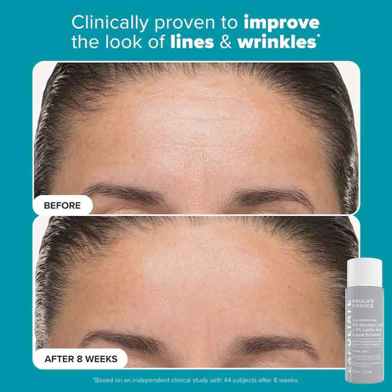 Paula's Choice 6% Mandelic Acid + 2% Lactic Acid Liquid Exfoliant, facial exfoliant, skincare for ageing skin, fine lines and wrinkles