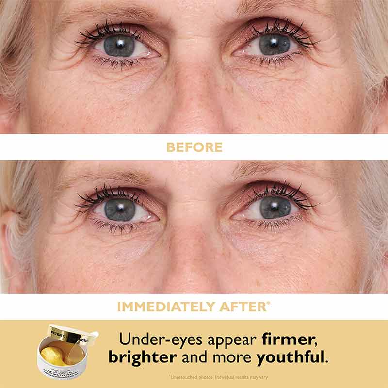 Peter Thomas Roth 24K Gold Glow-Up 2-Piece Gift Set Before and after eye patches