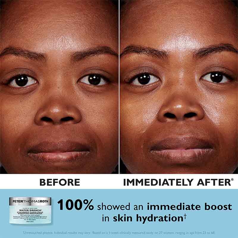 Peter Thomas Roth Cloud Cream Before & After