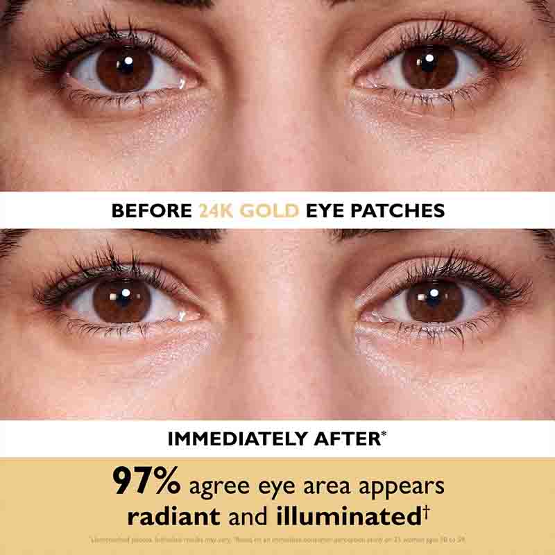 Before-and-after comparison of a woman's eyes, showing the effect of 24K gold eye patches. The top panel is labeled 'BEFORE 24K GOLD EYE PATCHES' and shows darker, less illuminated eyes.