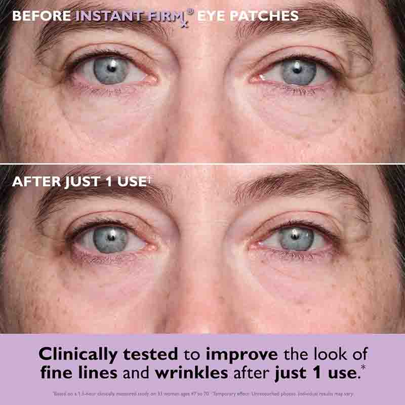 Before and after showing the effect of Instant Firm Eye Patches on eye area skin.