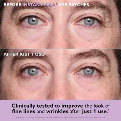 Before and after showing the effect of Instant Firm Eye Patches on eye area skin.