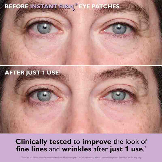 Before and after showing the effect of Instant Firm Eye Patches on eye area skin.