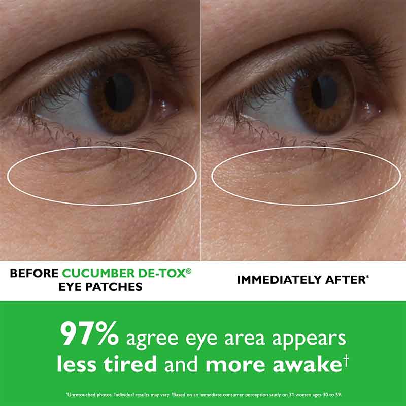 Before-and-after comparison of under-eye skin showing reduced puffiness and dark circles after applying cucumber de-tox eye patches. The top half shows a close-up of a brown eye with visible puffiness and a white oval highlight.