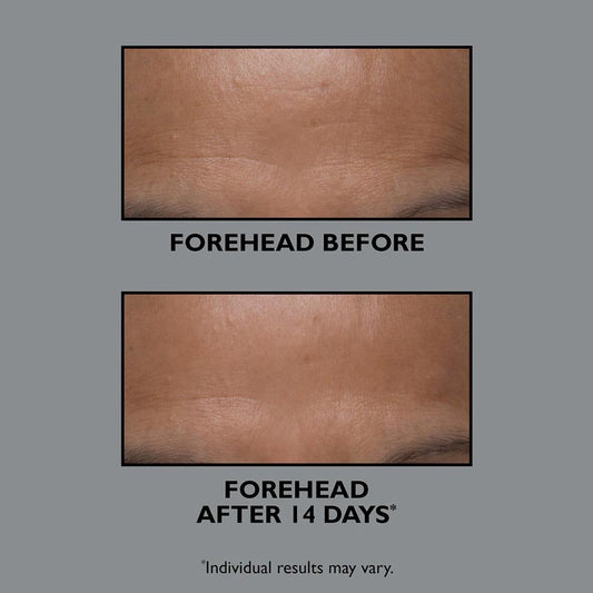 Peter Thomas Roth, Peter Thomas Roth FIRMx Collagen Moisturizer, Forehead Wrinkles, Forehead Lines