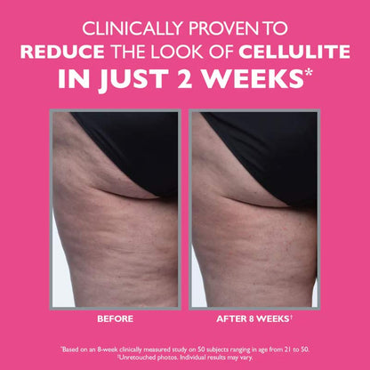 Peter Thomas Roth, Peter Thomas Roth FIRMx Tight & Toned Cellulite Treatment, Cellulite Treatment