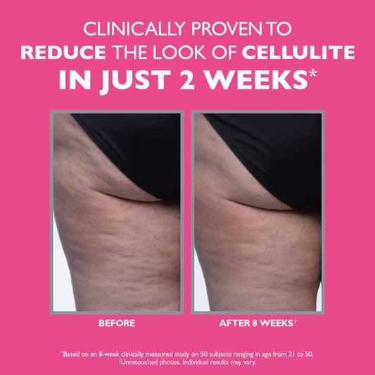 Peter Thomas Roth, Peter Thomas Roth FIRMx Tight & Toned Cellulite Treatment, Cellulite Treatment