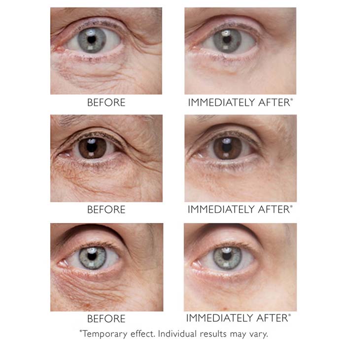 Peter Thomas Roth, Peter Thomas Roth Instant FIRMx Eye, anti-ageing, anti-ageing eye cream