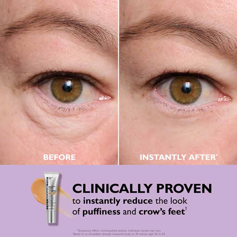 Peter Thomas Roth Instant FIRMx Temporary Eye Tightener - Easy Wear Formula before & after