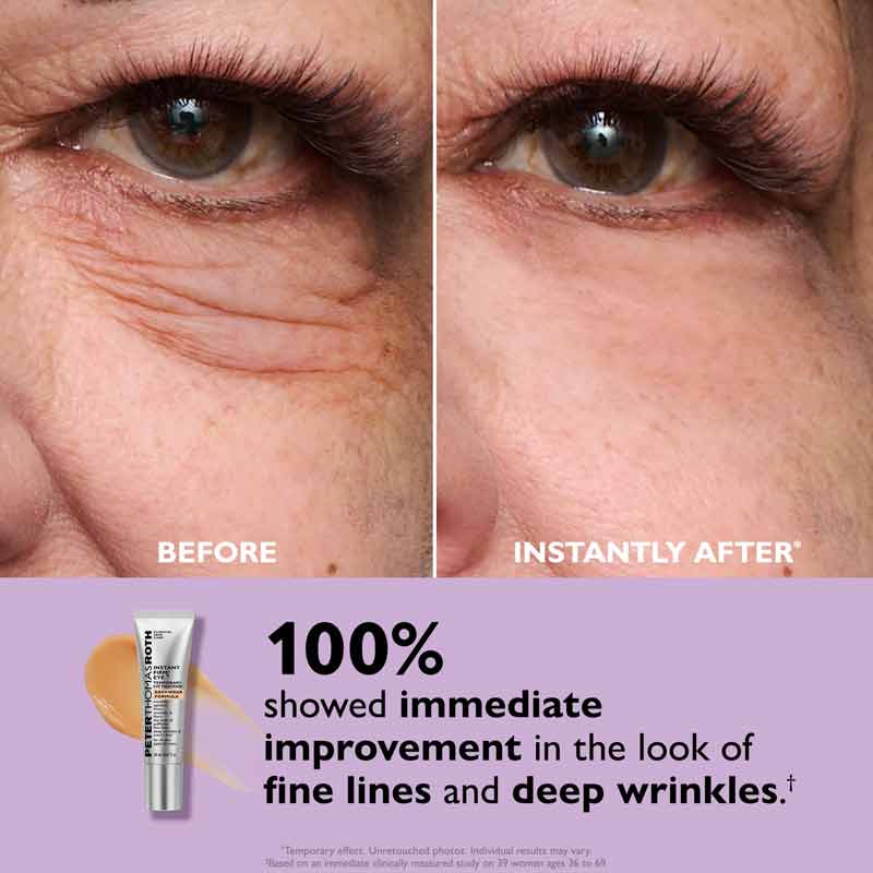 Peter Thomas Roth Instant FIRMx Temporary Eye Tightener Easy Wear Before & After