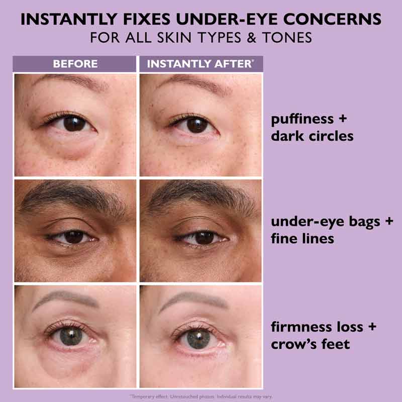 Peter Thomas Roth Instant FIRMx Temporary Eye Tightener - Easy Wear Formula before and after