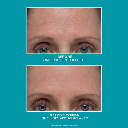 Peter Thomas Roth, Peter Thomas Roth Peptide Skinjection Amplified Wrinkle-Fix Serum, Reduce Fine Lines, Reduce Wrinkles