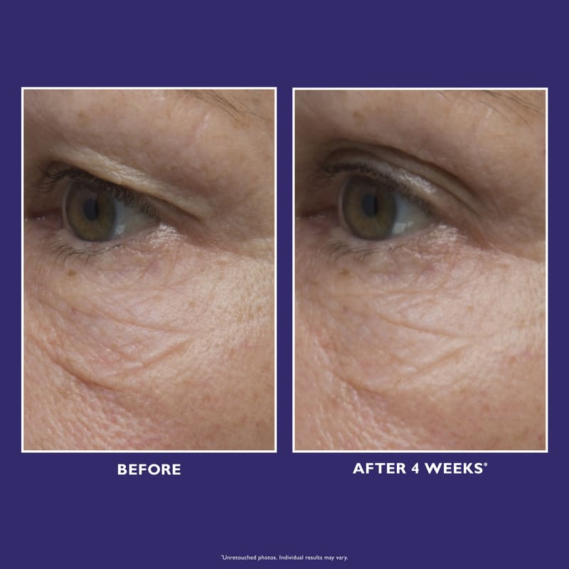 Peter Thomas Roth, Peter Thomas Roth Ultimate Solution 5 Multitasking Eye Cream, For Fine Lines And Wrinkles
