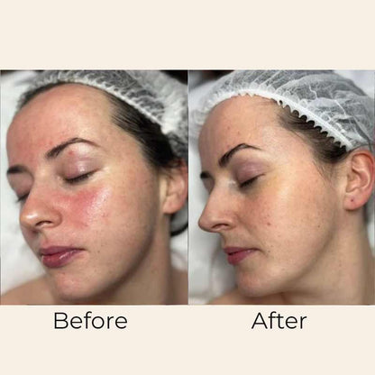 Skin Formulas, Skin Formulas Skin Mist Ceramide & Hyaluronic Before & After, soothing face mist, calming skincare