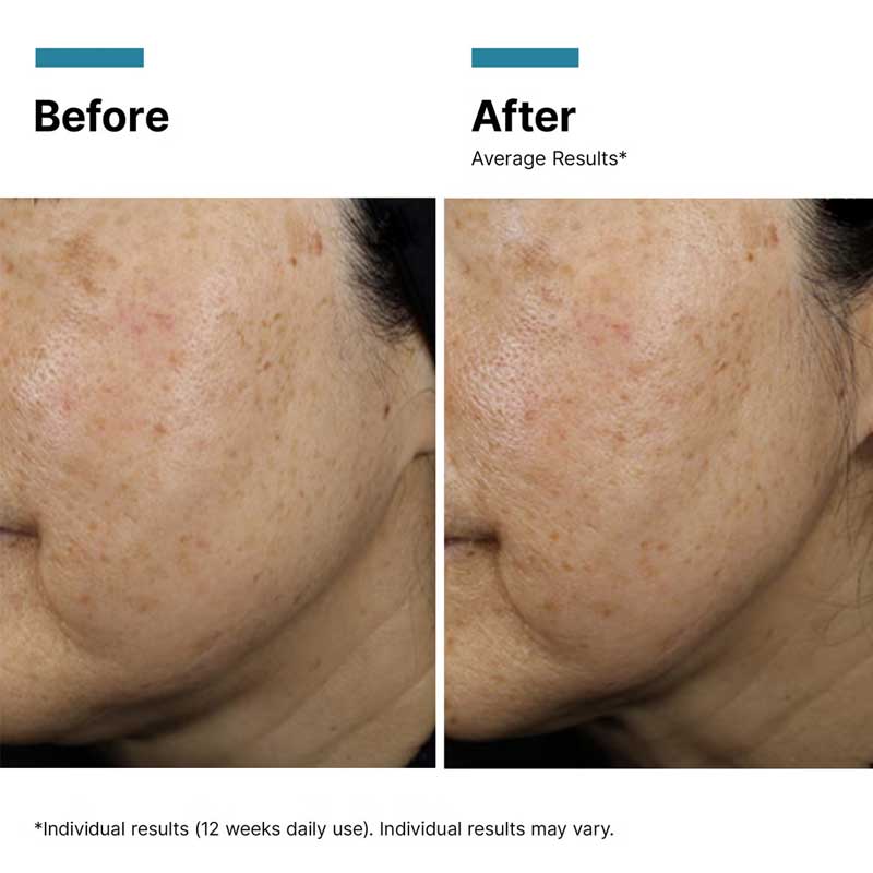 SkinCeuticals A.G.E. Interrupter Ultra Serum Results