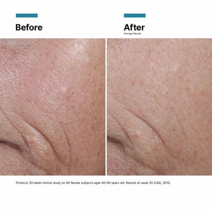 SkinCeuticals C E Ferulic with 15% L-Ascorbic Acid Results Before & After