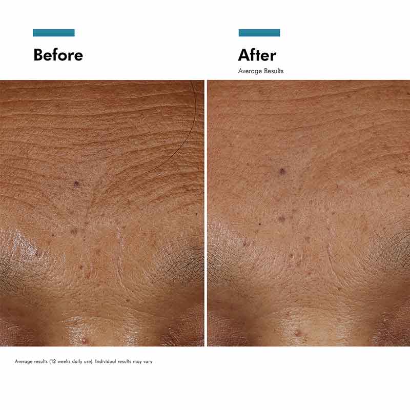 SkinCeuticals HA Intensifier Multi-Glycan Before & After