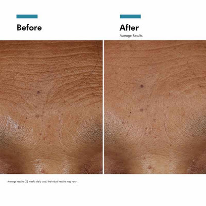 SkinCeuticals HA Intensifier Multi-Glycan Before & After