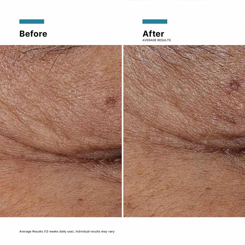 SkinCeuticals P-TIOX Wrinkle Modulating Peptide Serum Before & After
