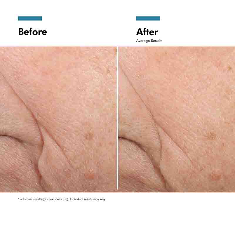 SkinCeuticals Triple Lipid Restore 2:4:2 Before & After