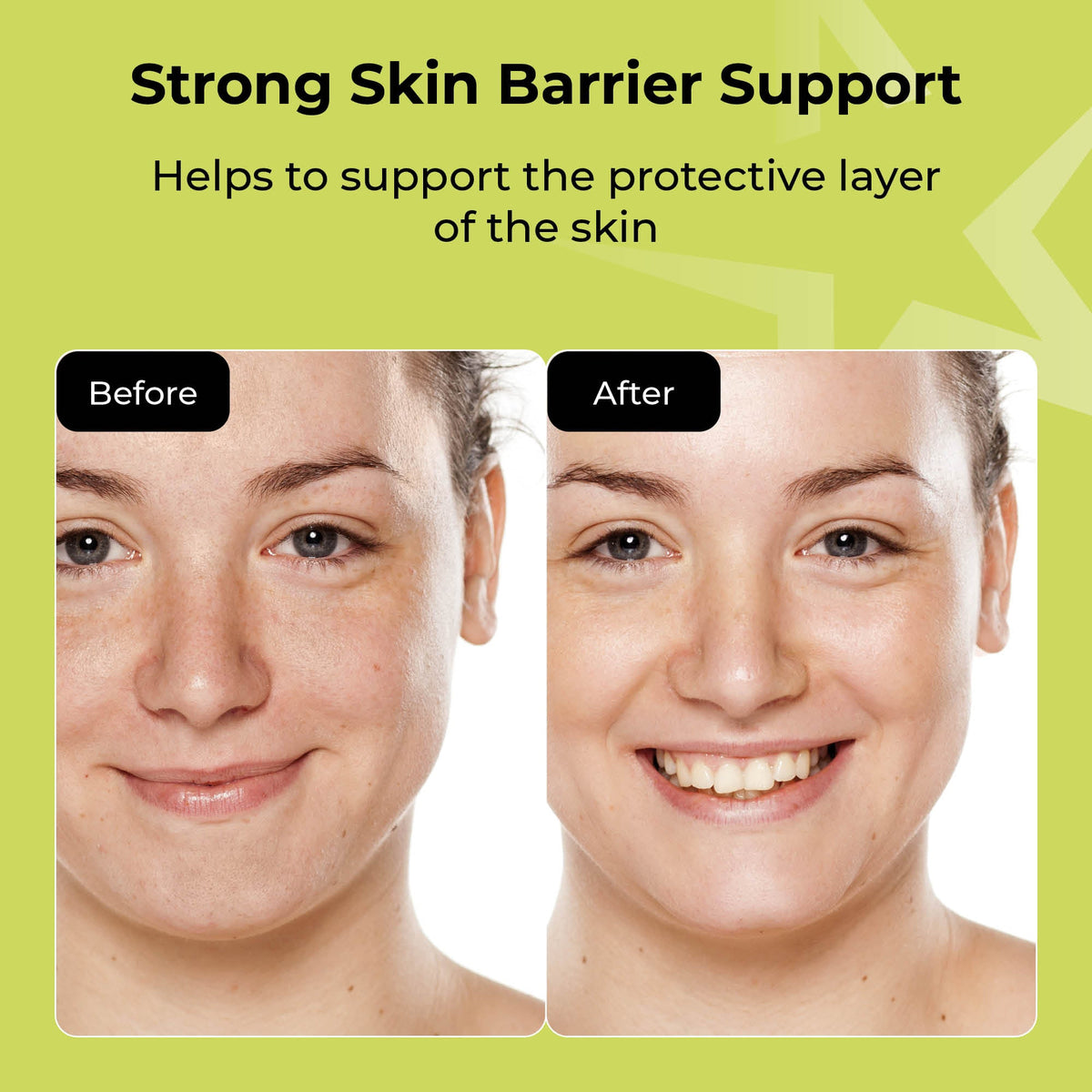 STARSKIN DeepMelt Collagen Green Caviar Hydrogel Face Mask Before and After Image, Model is radiant and glowy