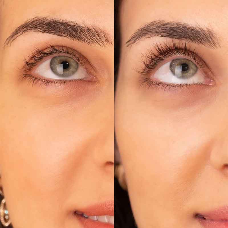 SWEED, longer lashes, Eyelash Growth Serum Set, eyelash growth serum