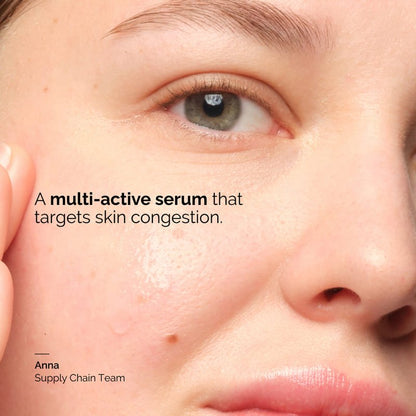 The Ordinary | Balancing & Clarifying Serum | Face Serum | Congested Skin 