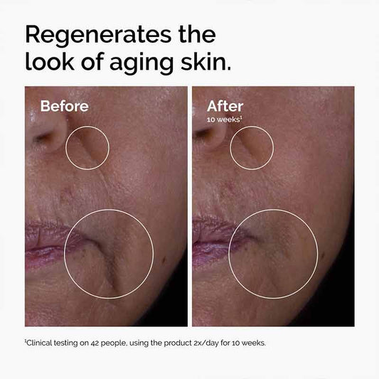 The Ordinary GF 15% Solution, serum for ageing skin, wrinkles, fine lines, crows feet