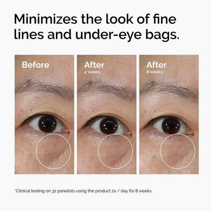 The Ordinary Lacto-PDRN 4% + B9 Lifting & Tightening Eye Cream Before & After Under Eye Bags