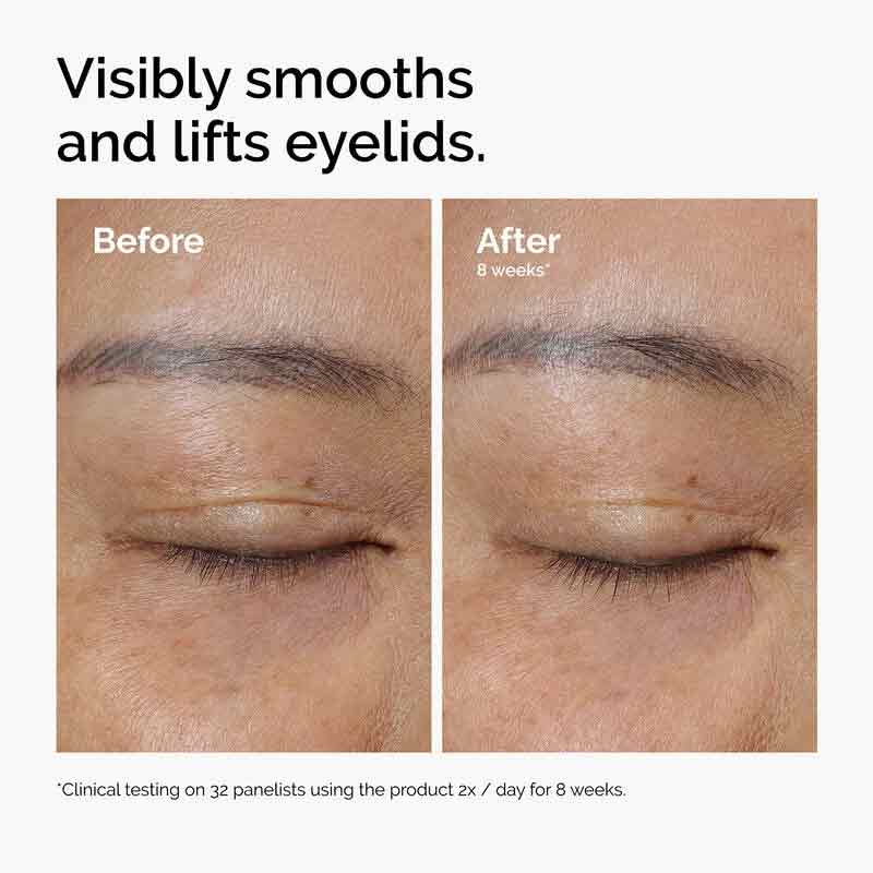 The Ordinary Lacto-PDRN 4% + B9 Lifting & Tightening Eye Cream Before & After On Eyelids