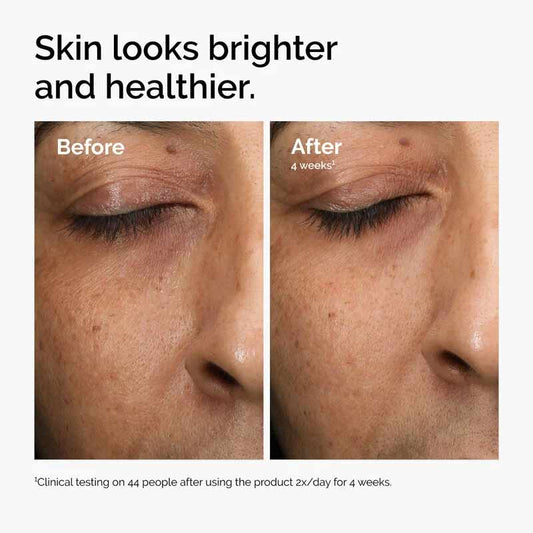 The Ordinary, The Ordinary Multi-Antioxidant Radiance Serum, Before and after radiance serum, dull skin