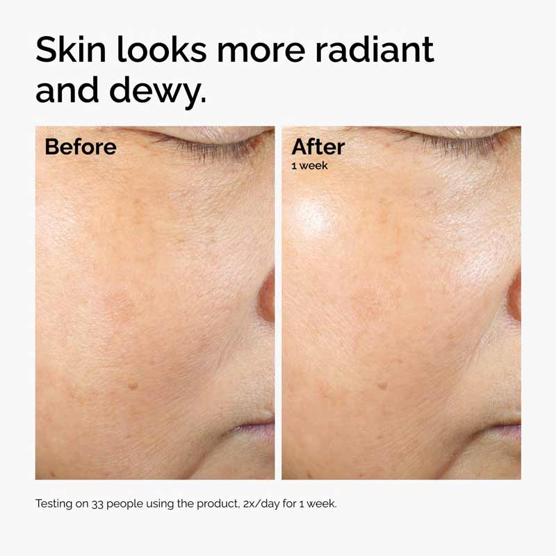 The Ordinary Rice Lipids + Ectoin Microemulsion Ultra-Lightweight Moisturiser Before and After