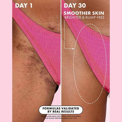 Truly Beauty Coco Cloud After Shave Serum Results On Bikini Line