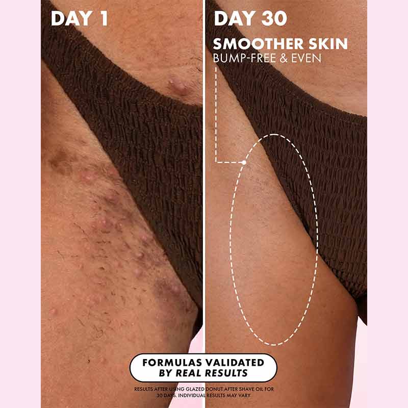 Truly Beauty Glazed Donut After Shave Oil Bikini Line Results