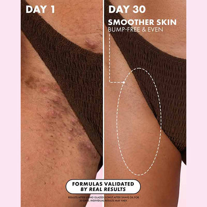 Truly Beauty Glazed Donut After Shave Oil Bikini Line Results
