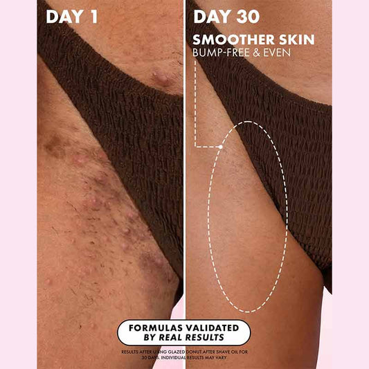 Truly Beauty Glazed Donut After Shave Oil Bikini Line Results
