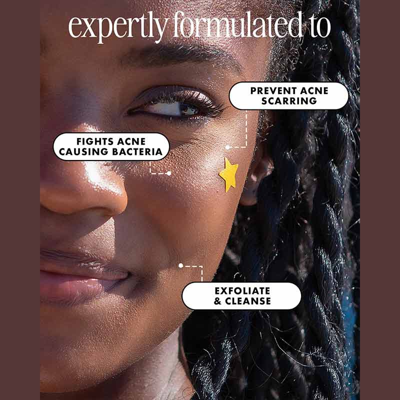 Truly Beauty Stars Scars Blemish Patches Benefits