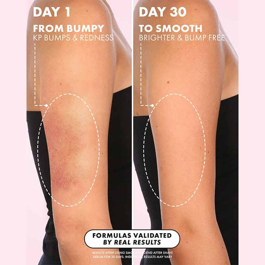 Truly Beauty Smooth Legend After Shave Serum Results