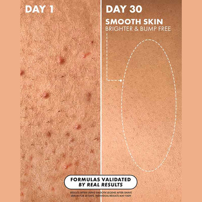 Truly Beauty Smooth Legend After Shave Serum Before And After