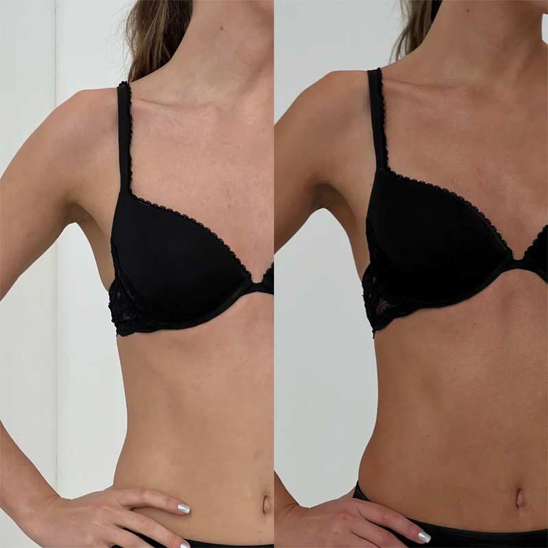 Vita Liberata | Fabulous Tinted Tanning Lotion | medium tan | Before & After