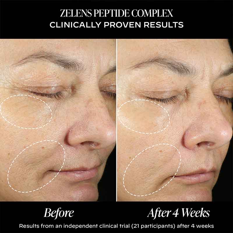 Zelens Peptide Complex Firming Cream Before & After