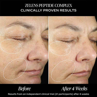 Zelens Peptide Complex Firming Cream Before & After