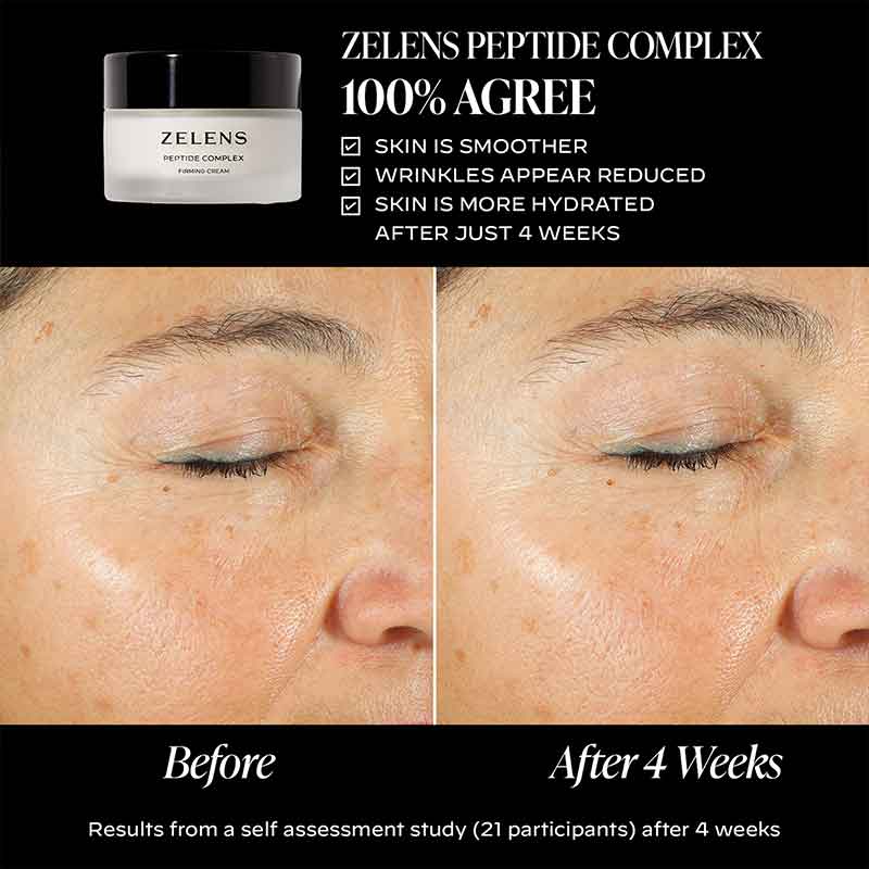 Zelens Peptide Complex Firming Cream Before & After