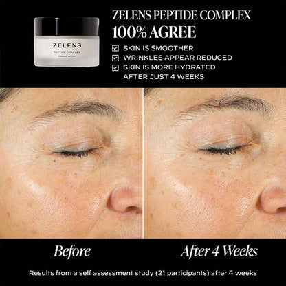 Zelens Peptide Complex Firming Cream Before & After